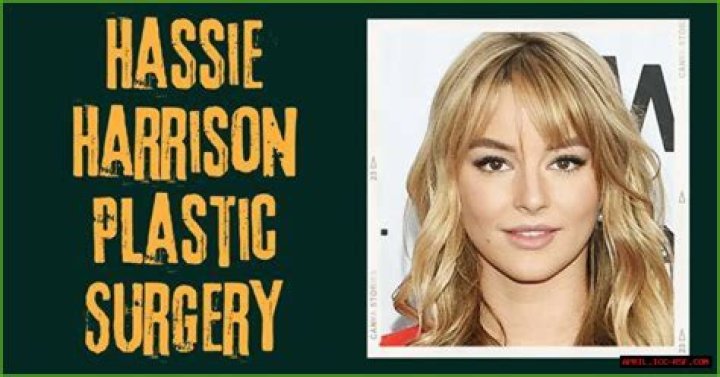 Hassie Harrison Plastic Surgery: Unraveling The Truth