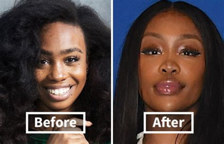 Unveiling SZA's Journey Before Surgery: Discoveries And Insights